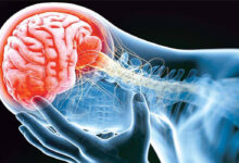 علائم تومور مغزی؛ از تغییرات بینایی تا اختلالات شناختی