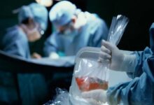 درج نشان اهدای عضو در گواهینامه رانندگی