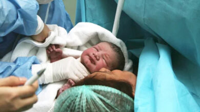 ضرورت غربالگری بینایی نوزادان در هفته های اول تولد