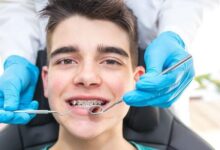 شل شدن روکش دندان می تواند نشانه ای از پوسیدگی پنهان باشد - خبرگزاری مهر ایران و جهان