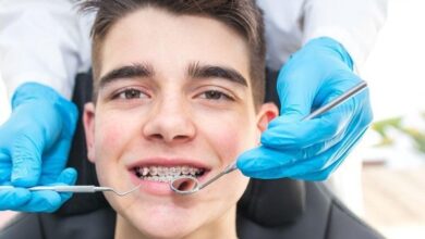 شل شدن روکش دندان می تواند نشانه ای از پوسیدگی پنهان باشد - خبرگزاری مهر ایران و جهان