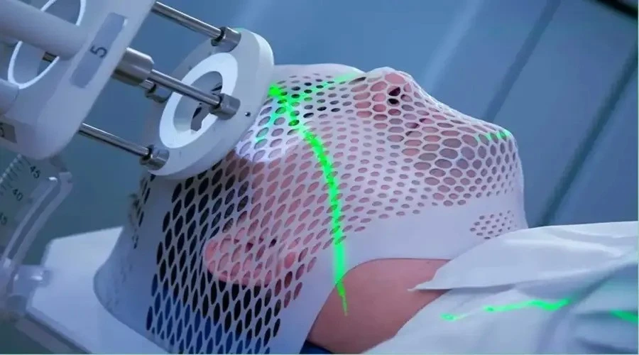 رادیوتراپی سرطان لب و زبان: آنچه باید در مورد آنها بدانید! - دکتر حسین یحیی زاده