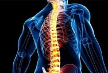 افزایش درد و مشکلات ستون فقرات در نسل جوان - خبرگزاری مهر ایران و جهان