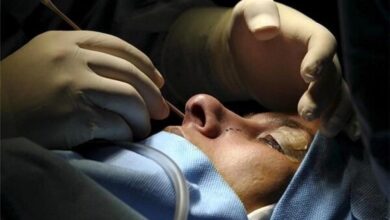 هشدار در مورد استفاده از ژل ها و محلول های زیبایی تزریقی: از محصولات تقلبی دوری کنید