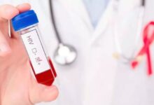 پویش ملی «من هم تست اچ‌آی‌وی می‌دهم»؛ گامی برای عبور از موانع