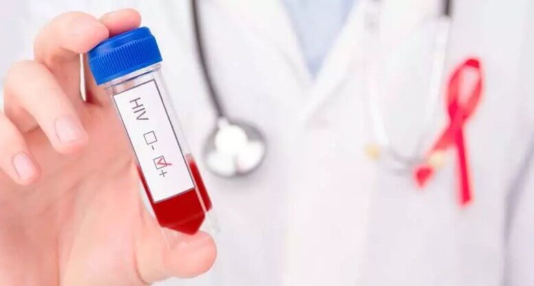 پویش ملی «من هم تست اچ‌آی‌وی می‌دهم»؛ گامی برای عبور از موانع