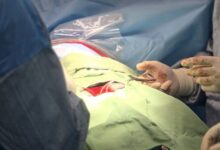 1200 اهدای عضو و 1000 پیوند موفقیت آمیز در سال 1403 ثبت شد.