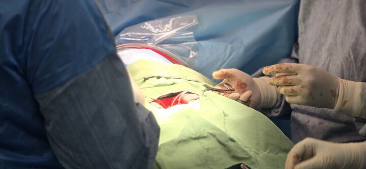 1200 اهدای عضو و 1000 پیوند موفقیت آمیز در سال 1403 ثبت شد.