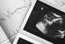 غربالگری در کشور ممنوع نیست و همچنان انجام می شود