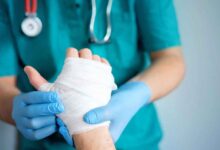 چالش برانگیزترین نوع سوختگی برای جراحان ترمیمی - خبرگزاری مهر | اخبار ایران و جهان