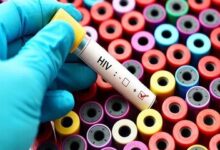 شناسایی 41000 بیمار HIV در کشور درمان رایگان در ایران