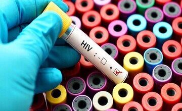 شناسایی 41000 بیمار HIV در کشور درمان رایگان در ایران