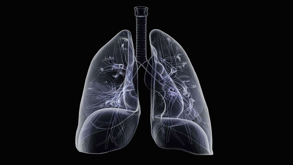 ذات الریه چیست؟ | علائم، علل و روش های درمانی برای پیشگیری و بهبودی سریع