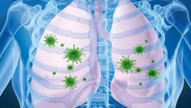 ذات الریه چیست؟ | علائم، علل و روش های درمانی برای پیشگیری و بهبودی سریع