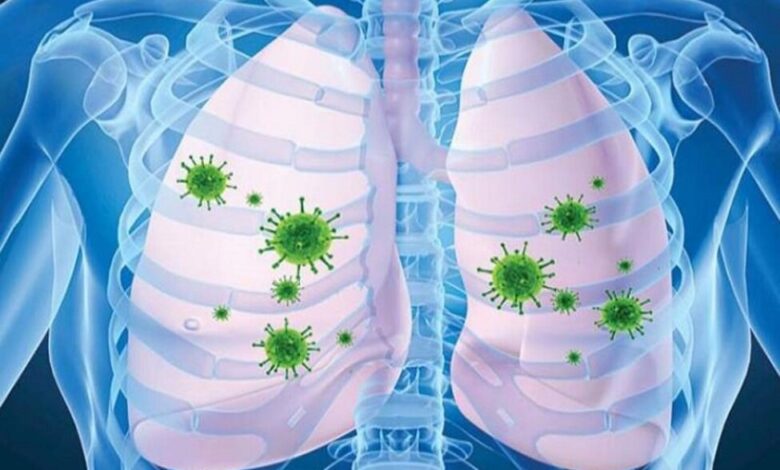 ذات الریه چیست؟ | علائم، علل و روش های درمانی برای پیشگیری و بهبودی سریع