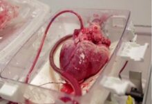 پیوند قلب برای پیوند به نوجوان 15 ساله با آمبولانس هوایی - خبرگزاری مهر ایران و جهان