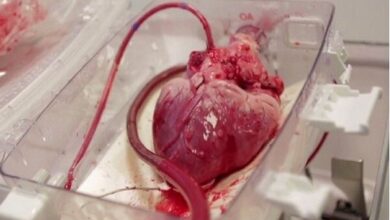 پیوند قلب برای پیوند به نوجوان 15 ساله با آمبولانس هوایی - خبرگزاری مهر ایران و جهان