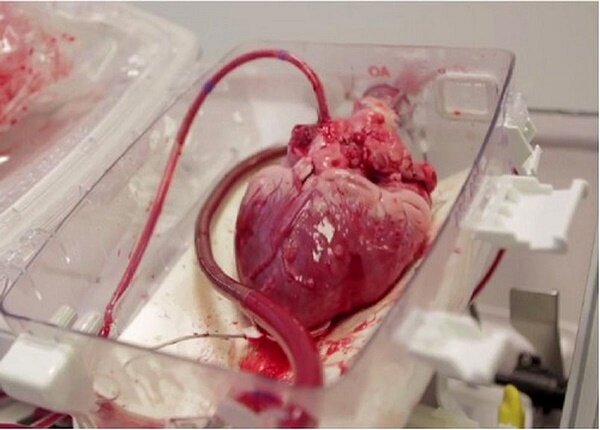 پیوند قلب برای پیوند به نوجوان 15 ساله با آمبولانس هوایی - خبرگزاری مهر ایران و جهان