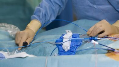 روش طلایی تشخیص تنگی عروق کرونر در بیماران - خبرگزاری مهر ایران و جهان