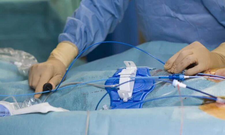 روش طلایی تشخیص تنگی عروق کرونر در بیماران - خبرگزاری مهر ایران و جهان