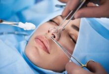 افزایش شکایت از جراحی های زیبایی - خبرگزاری مهر ایران و جهان