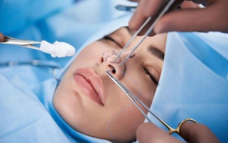 افزایش شکایت از جراحی های زیبایی - خبرگزاری مهر ایران و جهان