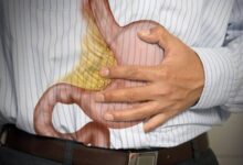 زخم معده پس از درمان کامل نیازی به مصرف طولانی مدت دارو ندارد - خبرگزاری مهر ایران و جهان