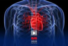 تفاوت مهم بیماری قلبی در زنان و مردان - خبرگزاری مهر ایران و جهان