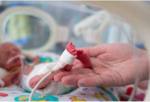 10 درصد از تولدها در ایران نوزادان نارس هستند - خبرگزاری مهر ایران و جهان