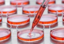 جذب داوطلب برای اهدای سلول های بنیادی برای اولین بار در نماز جمعه - خبرگزاری مهر ایران و جهان