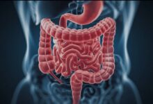 شیوع مشکلات گوارشی در دوران یائسگی - خبرگزاری مهر ایران و جهان