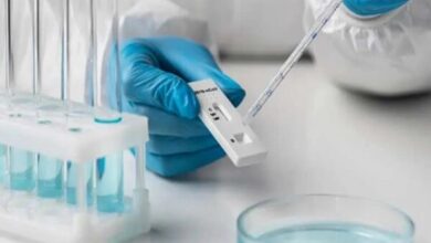 برخی از کیت های داخلی و خارجی کیفیت لازم را ندارند - خبرگزاری مهر ایران و جهان