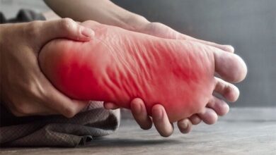 داغ شدن کف پا در شب؛ نشانه اختلال عصبی یا متابولیک - خبرگزاری مهر ایران و جهان