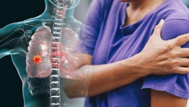 شانه یخ‌زده چیست؟ - خبرگزاری سلامت