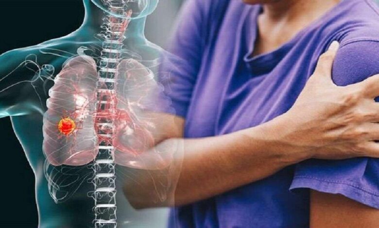 شانه یخ‌زده چیست؟ - خبرگزاری سلامت