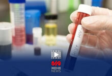 حدود 41000 نفر در کشور به HIV مبتلا هستند