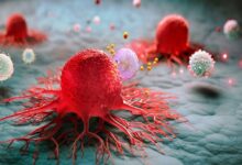 سرطان چگونه باعث مرگ می شود؟ نظریه جدید لخته شدن خون - خبرگزاری مهر | اخبار ایران و جهان