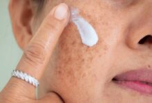 آلودگی هوا و پوست؛ چگونه از التهاب و خطر ابتلا به سرطان جلوگیری کنیم؟ - خبرگزاری مهر اخبار ایران و جهان