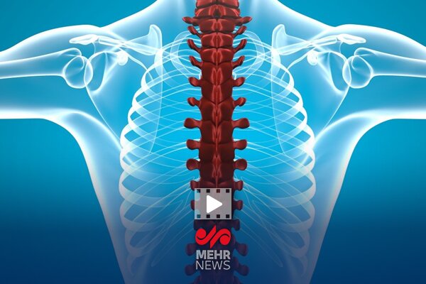 فلج اندام یکی از عوارض شکستن کالانجا توسط ماساژور است - خبرگزاری مهر ایران و جهان