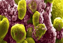 تاثیر ترکیب دارویی در کاهش خطر مرگ ناشی از سرطان - خبرگزاری مهر ایران و جهان