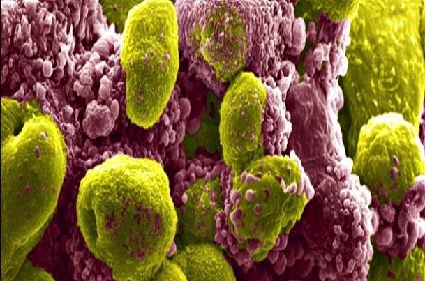 تاثیر ترکیب دارویی در کاهش خطر مرگ ناشی از سرطان - خبرگزاری مهر ایران و جهان