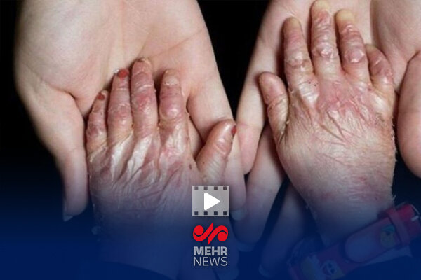 اساسنامه بنیاد بیماران خاص بازنگری نشده است