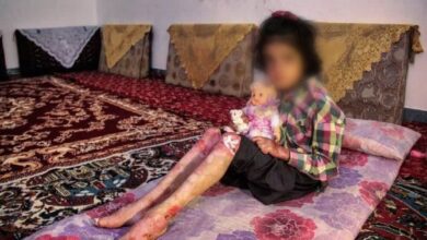 بیماران پروانه ای نیازمند حمایت دولت برای دسترسی به داروهای گران قیمت هستند