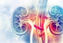 پیشگیری از بیماری های کلیوی با معاینات منظم و مصرف صحیح مایعات امکان پذیر است