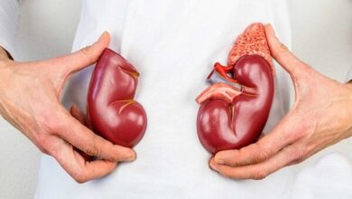 پیشگیری از بیماری های کلیوی با چکاپ های منظم - خبرگزاری مهر ایران و جهان