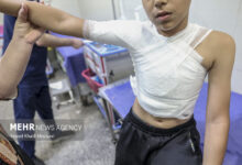 حادثه دردناکی به نام «سوختن» در ایران! - خبرگزاری مهر اخبار ایران و جهان