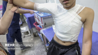 حادثه دردناکی به نام «سوختن» در ایران! - خبرگزاری مهر اخبار ایران و جهان