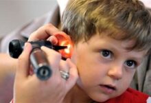 پوشش 96 درصدی غربالگری شنوایی در کشور - خبرگزاری مهر ایران و جهان