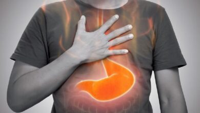 رفلاکس معده چیست و چگونه درمان می شود؟ | چه غذاهایی باعث رفلاکس معده می شود؟