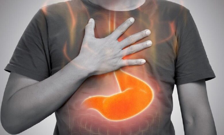 رفلاکس معده چیست و چگونه درمان می شود؟ | چه غذاهایی باعث رفلاکس معده می شود؟